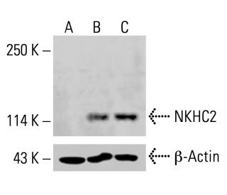 NKHC2 Antibody (E-5) - Western Blotting - Image 414581 