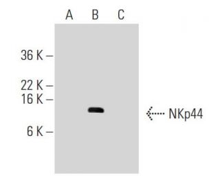 NKp44 Antibody (8F12) - Western Blotting - Image 47924Each CRISPR/Cas9 Knockout (KO) Plasmid product consists of a pool of 3 plasmids designed to ensure identification and cleavage of a specific gene for maximum knockout efficiency. Each plasmid encodes a unique 20 nt sequence derived from the GeCKO (v2) library.