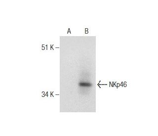 NKp46 Antibody (9E2) - Western Blotting - Image 160703Each CRISPR/Cas9 Knockout (KO) Plasmid product consists of a pool of 3 plasmids designed to ensure identification and cleavage of a specific gene for maximum knockout efficiency. Each plasmid encodes a unique 20 nt sequence derived from the GeCKO (v2) library.