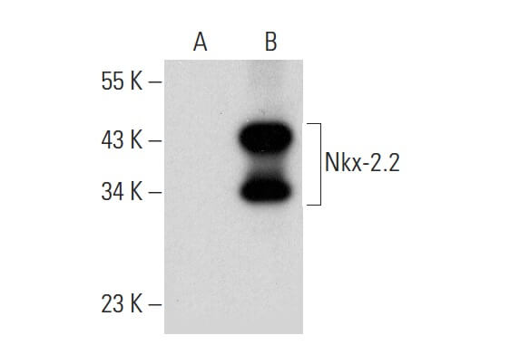 Nkx-2.2 Antibody (D-4) | SCBT - Santa Cruz Biotechnology
