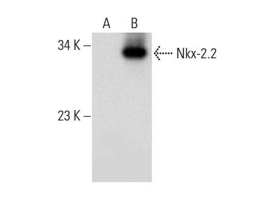 Nkx-2.2 Antibody (F-2) | SCBT - Santa Cruz Biotechnology