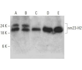 nm23-H2 Antibody (X-42) - Western Blotting - Image 368208 