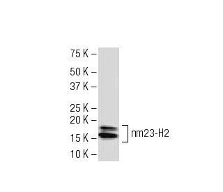 nm23-H2 Antibody (X-42) - Western Blotting - Image 33776