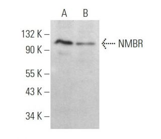 NMBR Antibody (G-3) - Western Blotting - Image 364681SAM Transcription Activation: SAM system utilizing dCas9-VP64, MS2-P65-HSF1, and sgRNA for precise gene transcription activation.