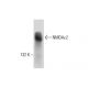 western blotting image from recommended NMDAε2 (A-8) monoclonal antibody replacement. Image 142724