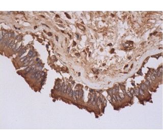 immunohistochemistry image from recommended NMDAε4 (G-10) monoclonal antibody replacement. Image 289166