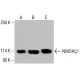 NMDAζ1 Antibody (F-10): sc-518053. Western blot analysis of NMDAζ1 expression in HeLa (A), K-562 (B) and HCT-116 (C) whole cell lysates. Detection reagent used: m-IgG Fc BP-HRP: sc-525409. NMDAζ1 Antibody (F-10) - Western Blotting - Image 416143