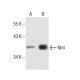 western blotting image from recommended Nmi (D-10) monoclonal antibody replacement. Image 281854