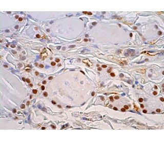 NMNAT-1 Antibody (B-7) | SCBT - Santa Cruz Biotechnology NMNAT-1 Antibody (B-7) | SCBT - Santa Cruz Biotechnology