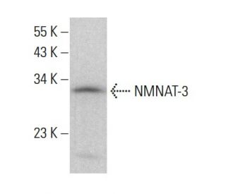 NMNAT-3 Antibody (D-10) - Western Blotting - Image 383795SAM Transcription Activation: SAM system utilizing dCas9-VP64, MS2-P65-HSF1, and sgRNA for precise gene transcription activation. 