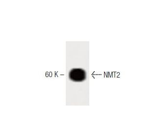 NMT2 Antibody (30) - Western Blotting - Image 60383 