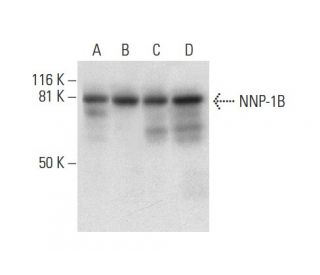 NNP-1B Antibody (C-12) - Western Blotting - Image 303397 