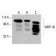 NNP-1B Antibody (C-12): sc-398162. Western blot analysis of NNP-1B expression in HeLa (A), K-562 (B) and HCT-116 (C) whole cell lysates. Detection reagent used: m-IgG Fc BP-HRP: sc-525409. NNP-1B Antibody (C-12) - Western Blotting - Image 415418