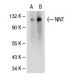 NNT Antibody (43-R17) - Western Blotting - Image 30427