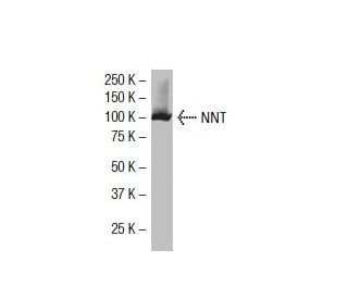 NNT Antibody (43-R17) - Western Blotting - Image 33861 
