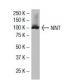 NNT Antibody (43-R17) - Western Blotting - Image 33861 