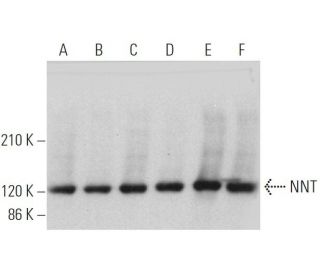 NNT Antibody (B-3) - Western Blotting - Image 373116 
