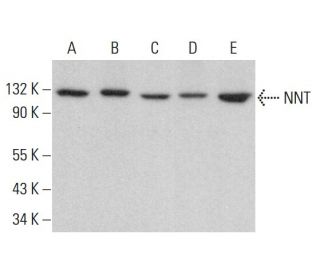 NNT Antibody (B-3) - Western Blotting - Image 383303Each CRISPR/Cas9 Knockout (KO) Plasmid product consists of a pool of 3 plasmids designed to ensure identification and cleavage of a specific gene for maximum knockout efficiency. Each plasmid encodes a unique 20 nt sequence derived from the GeCKO (v2) library.