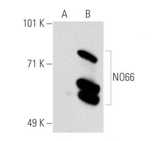 NO66 Antibody (3354C5a) - Western Blotting - Image 20729 