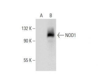NOD1 Antibody (F-6) - Western Blotting - Image 304341