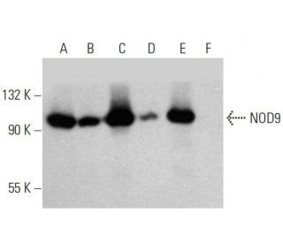 NOD9 Antibody (F-2) - Western Blotting - Image 358649 