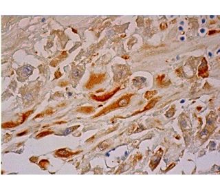 immunohistochemistry image from recommended Nodal (G-10) monoclonal antibody replacement. Image 286421