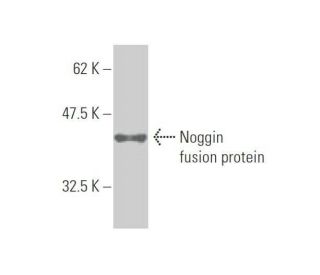 western blotting image from recommended Noggin (2C10) monoclonal antibody replacement. Image 348992
