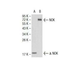 NOK Antibody (2H2F10) - Western Blotting - Image 137448