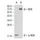NOK Antibody (2H2F10) - Western Blotting - Image 137448