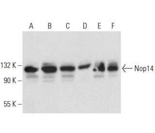 Nop14 Antibody (B-5) - Western Blotting - Image 308405 