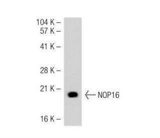 NOP16 Antibody (JJ-39) - Western Blotting - Image 36457 