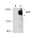 NOPE Antibody (27L-2) - Western Blotting - Image 154027