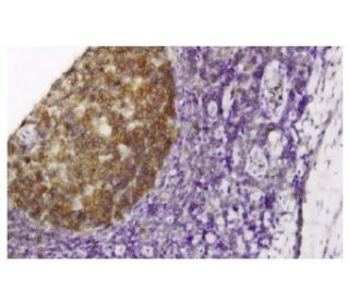 Nopp140 Antibody (3B4) - Immunohistochemistry - Image 36291