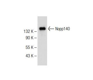 Nopp140 Antibody (E-7) - Western Blotting - Image 147828