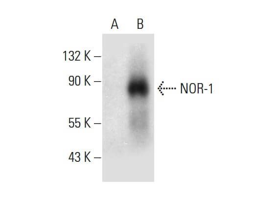 NOR-1 Antibody (H-7) | SCBT - Santa Cruz Biotechnology