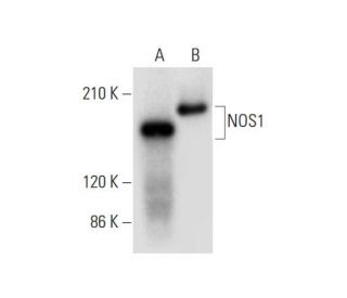 NOS1 Antibody (G-4) - Western Blotting - Image 309641 