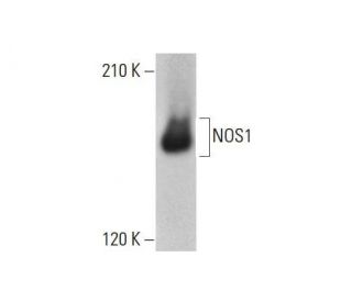 NOS1 Antibody (H-7) - Western Blotting - Image 351988 