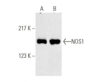 NOS1 Antibody (A-11) - Western Blotting - Image 7777