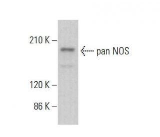 pan NOS Antibody (NOS-3F7-B11 B5) - Western Blotting - Image 379635