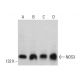 This polyclonal antibody has been discontinued. See our recommended <a href="nos3-antibody-a-9">eNOS (A-9)</a> monoclonal antibody (sample data shown). western blotting image from recommended eNOS (A-9) monoclonal antibody replacement. Image 381049