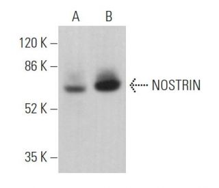 NOSTRIN Antibody (F-10) - Western Blotting - Image 361954 