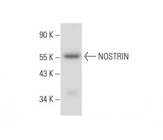 NOSTRIN Antibody (F-4) - Western Blotting - Image 139096 