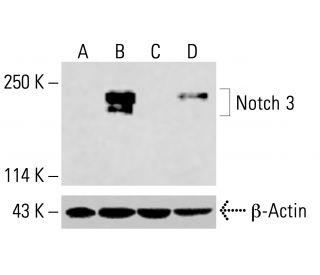 Notch 3 Antibody (A-6) - Western Blotting - Image 416110The Double Nickase Plasmid features a U6 promoter for sgRNA expression, a 20 nt targeting sequence, and a gRNA scaffold to guide Cas9n. It includes a CBh promoter for Cas9n (D10A) and puromycin resistance, GFP for transfection verification, and nuclear localization signals (NLS). The 2A peptide allows co-expression of Cas9n and Puro from a single promoter, enabling precise genome editing with reduced off-target effects.