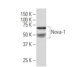 Nova-1 Antibody (512Y) - Western Blotting - Image 33711