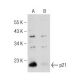 Novobiocin Sodium (U-6591): sc-358734. Western blot analysis of p21 expression in untreated (A) and Novobiocin Sodium (U-6 