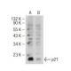 Novobiocin Sodium (U-6591): sc-358734. Western blot analysis of p21 expression in untreated (A) and Novobiocin Sodium (U-6
