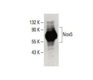 Nox5 Antibody (A-3) - Western Blotting - Image 395972The Double Nickase Plasmid features a U6 promoter for sgRNA expression, a 20 nt targeting sequence, and a gRNA scaffold to guide Cas9n. It includes a CBh promoter for Cas9n (D10A) and puromycin resistance, GFP for transfection verification, and nuclear localization signals (NLS). The 2A peptide allows co-expression of Cas9n and Puro from a single promoter, enabling precise genome editing with reduced off-target effects.