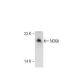 western blotting image from recommended NOXA (114C307) monoclonal antibody replacement. Image 35425