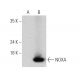 western blotting image from recommended NOXA (F-3) monoclonal antibody replacement. Image 368575