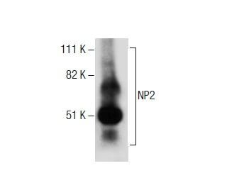 NP2 Antibody (22) - Western Blotting - Image 285111